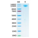 Tris-Bis PAGE - Recombinant SARS-CoV-2 Spike RBD Protein (C-terminal His and Avi Tag) (A331840) - Antibodies.com