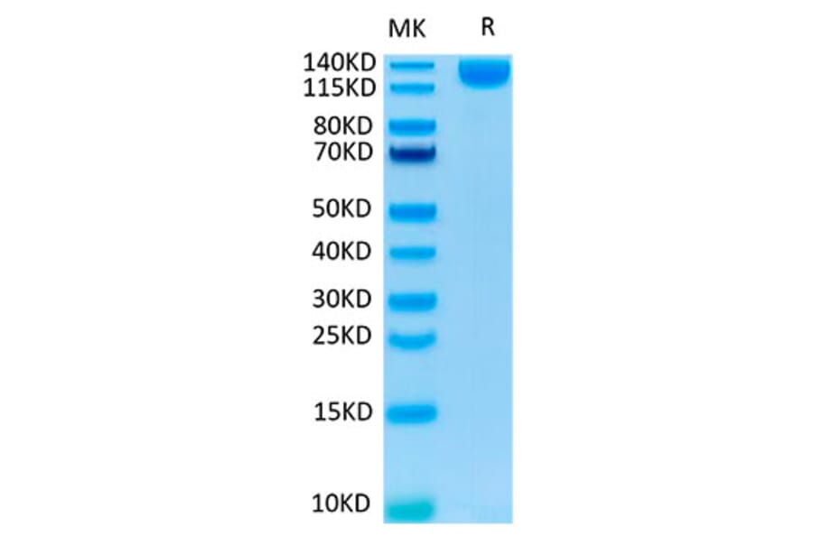 Tris-Bis PAGE - Recombinant SARS-CoV-2 Spike RBD Protein (C-terminal Human Fc and Avi Tag) (A331841) - Antibodies.com