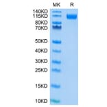 Tris-Bis PAGE - Recombinant SARS-CoV-2 Spike RBD Protein (C-terminal His and Avi Tag) (A331842) - Antibodies.com