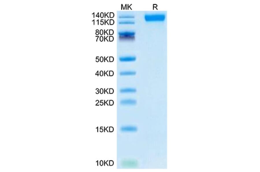 Tris-Bis PAGE - Recombinant SARS-CoV-2 Spike RBD Protein (C-terminal His Tag) (A331843) - Antibodies.com