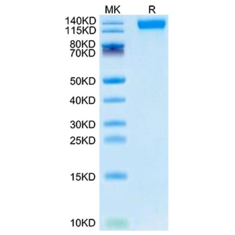 Tris-Bis PAGE - Recombinant SARS-CoV-2 Spike RBD Protein (C-terminal His Tag) (A331843) - Antibodies.com