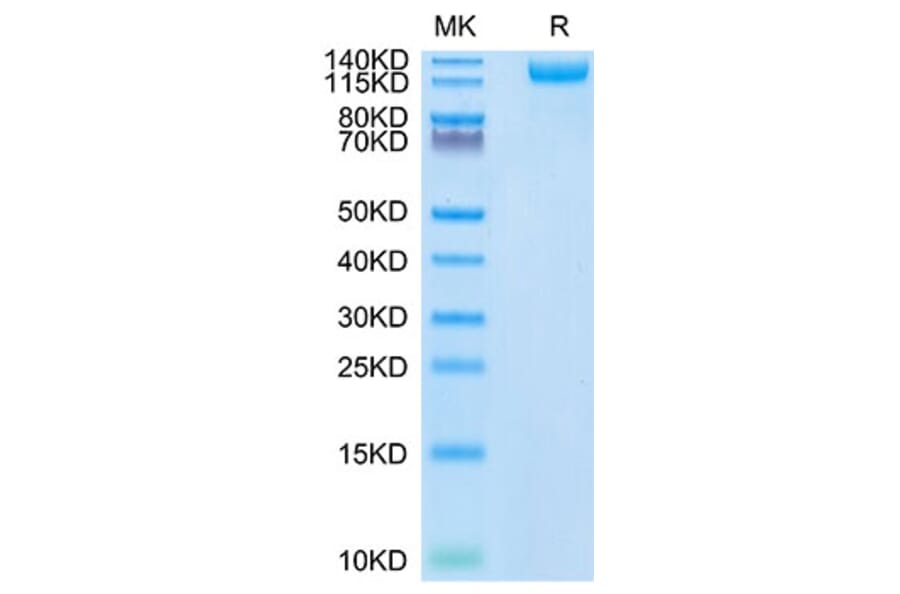 Tris-Bis PAGE - Recombinant SARS-CoV-2 Spike RBD Protein (C-terminal His Tag) (A331844) - Antibodies.com