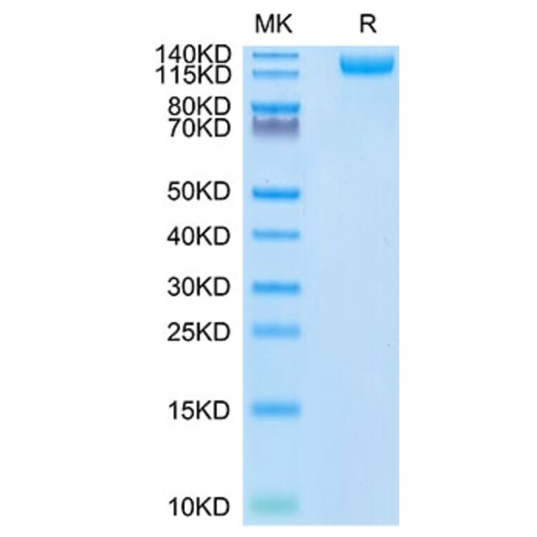 Tris-Bis PAGE - Recombinant SARS-CoV-2 Spike RBD Protein (C-terminal His Tag) (A331844) - Antibodies.com
