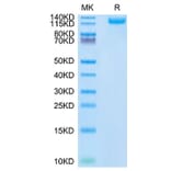 Tris-Bis PAGE - Recombinant SARS-CoV-2 Spike RBD Protein (C-terminal His Tag) (A331844) - Antibodies.com