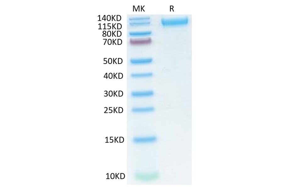Tris-Bis PAGE - Recombinant SARS-CoV-2 Spike RBD Protein (C-terminal His Tag) (A331845) - Antibodies.com