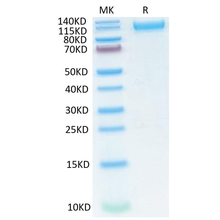 Tris-Bis PAGE - Recombinant SARS-CoV-2 Spike RBD Protein (C-terminal His Tag) (A331845) - Antibodies.com