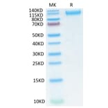 Tris-Bis PAGE - Recombinant SARS-CoV-2 Spike RBD Protein (C-terminal His Tag) (A331845) - Antibodies.com