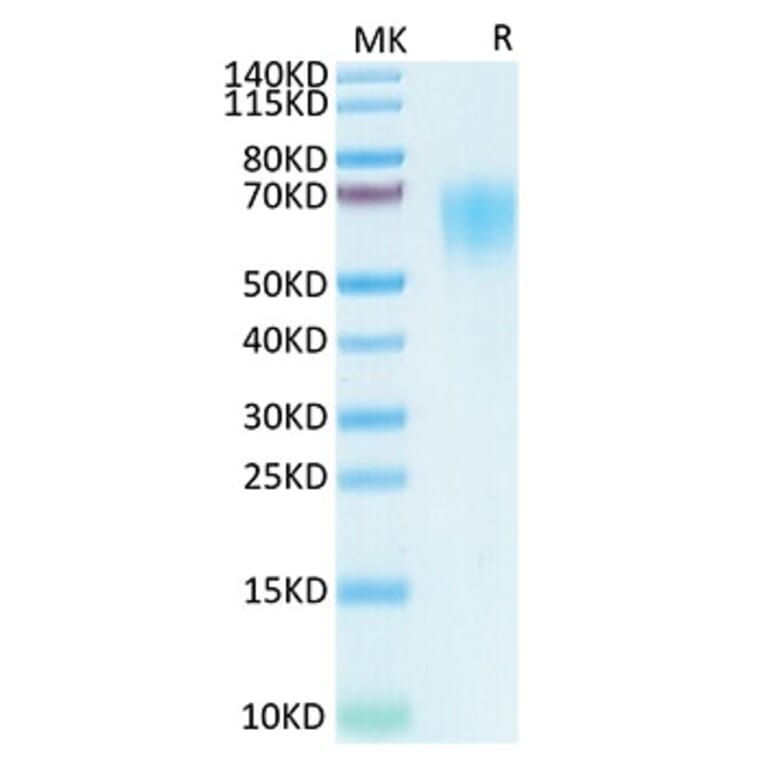 Tris-Bis PAGE - Recombinant SARS-CoV-2 Spike RBD Protein (C-terminal His and Flag Tag) (A331846) - Antibodies.com
