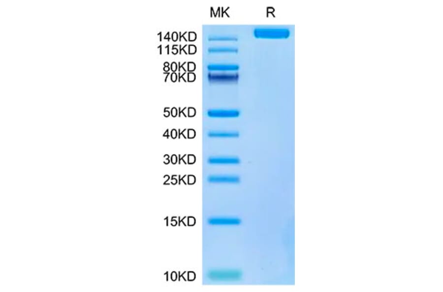 Tris-Bis PAGE - Recombinant SARS-CoV-2 Spike RBD Protein (C-terminal His and Avi Tag) (A331847) - Antibodies.com