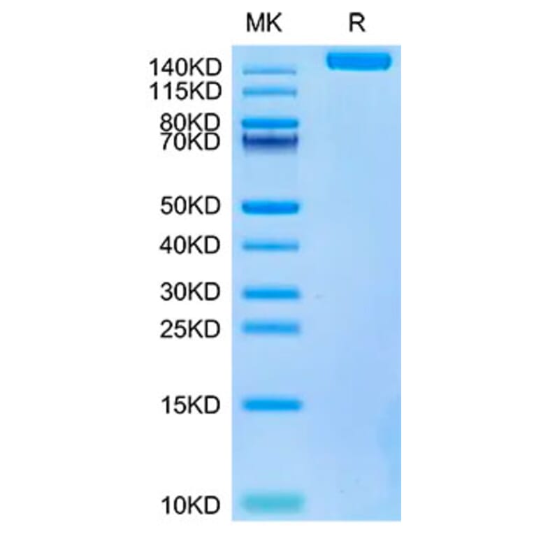 Tris-Bis PAGE - Recombinant SARS-CoV-2 Spike RBD Protein (C-terminal His and Avi Tag) (A331847) - Antibodies.com