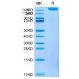 Tris-Bis PAGE - Recombinant SARS-CoV-2 Spike RBD Protein (C-terminal His and Avi Tag) (A331847) - Antibodies.com