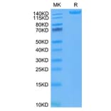 Tris-Bis PAGE - Recombinant SARS-CoV-2 Spike RBD Protein (C-terminal His and Avi Tag) (A331849) - Antibodies.com
