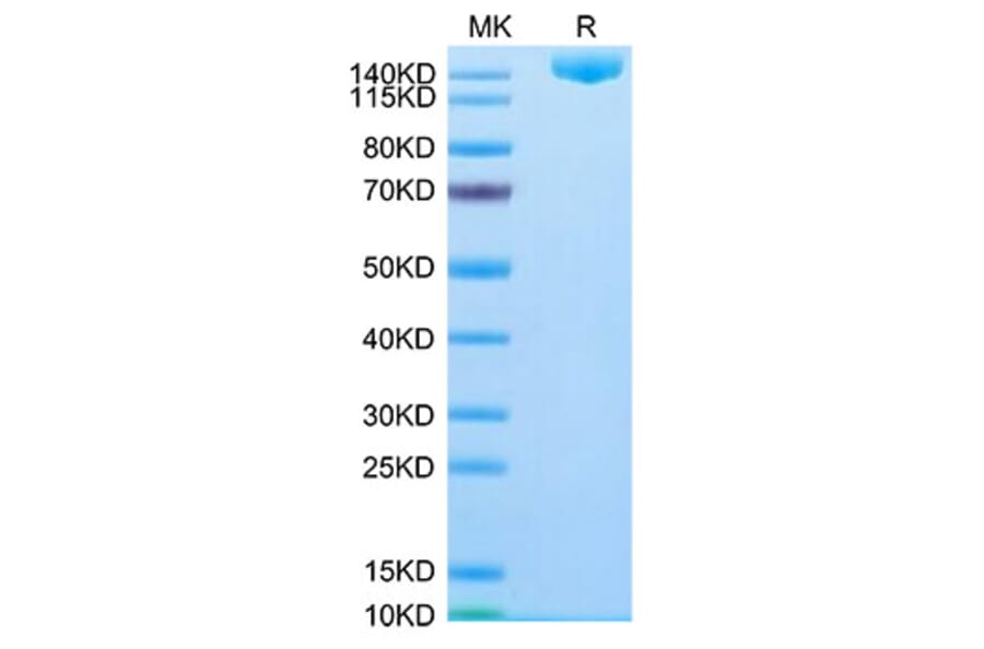 Tris-Bis PAGE - Recombinant SARS-CoV-2 Spike RBD Protein (C-terminal His Tag) (A331850) - Antibodies.com