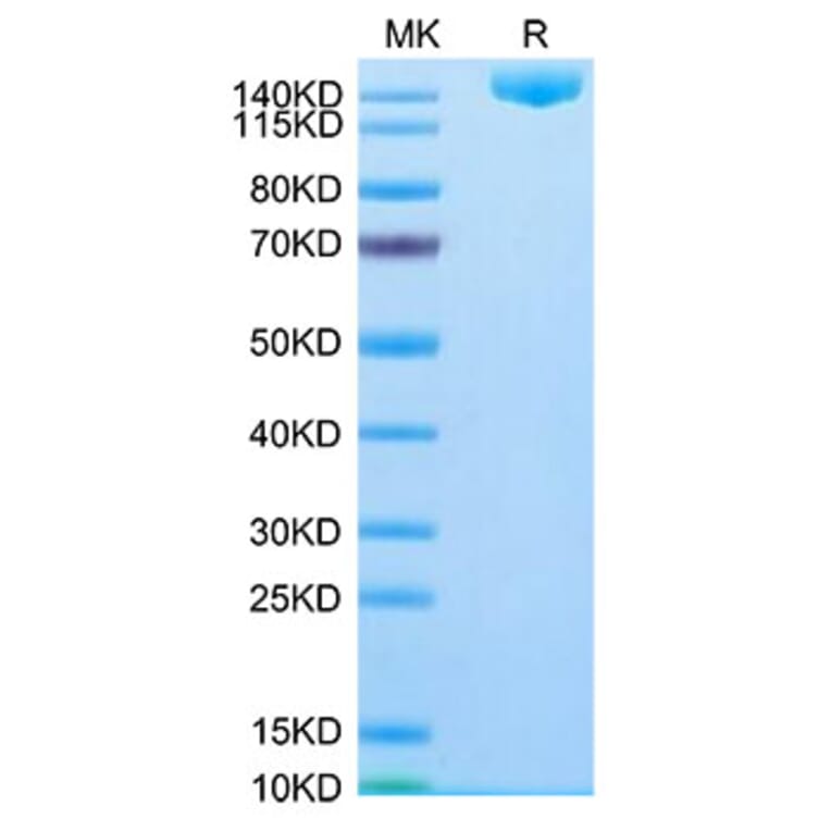 Tris-Bis PAGE - Recombinant SARS-CoV-2 Spike RBD Protein (C-terminal His Tag) (A331850) - Antibodies.com