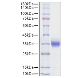 SDS-PAGE - Recombinant Rat Sclerostin Protein (C-terminal His Tag) (A331851) - Antibodies.com