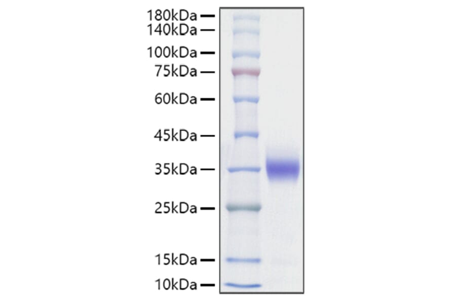 SDS-PAGE - Recombinant Rat Sclerostin Protein (C-terminal His Tag) (A331851) - Antibodies.com