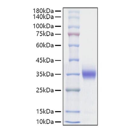 SDS-PAGE - Recombinant Rat Sclerostin Protein (C-terminal His Tag) (A331851) - Antibodies.com