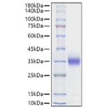 SDS-PAGE - Recombinant Rat Sclerostin Protein (C-terminal His Tag) (A331851) - Antibodies.com