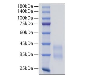 SDS-PAGE - Recombinant Mouse Sclerostin Protein (C-terminal His Tag) (A331852) - Antibodies.com