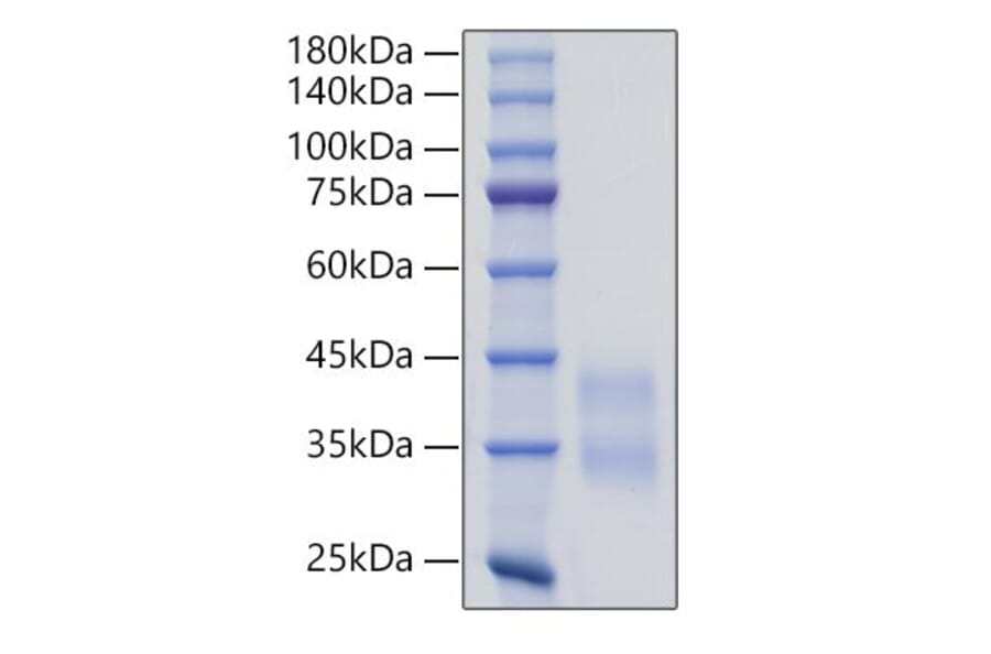 SDS-PAGE - Recombinant Mouse Sclerostin Protein (C-terminal His Tag) (A331852) - Antibodies.com