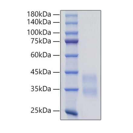 SDS-PAGE - Recombinant Mouse Sclerostin Protein (C-terminal His Tag) (A331852) - Antibodies.com
