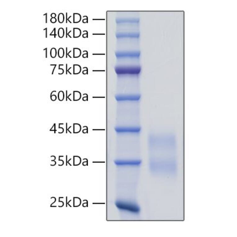 SDS-PAGE - Recombinant Mouse Sclerostin Protein (C-terminal His Tag) (A331852) - Antibodies.com