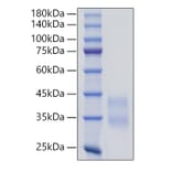 SDS-PAGE - Recombinant Mouse Sclerostin Protein (C-terminal His Tag) (A331852) - Antibodies.com