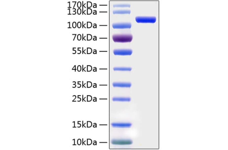 SDS-PAGE - Recombinant Human SEMA5A Protein (C-terminal His Tag) (A331853) - Antibodies.com