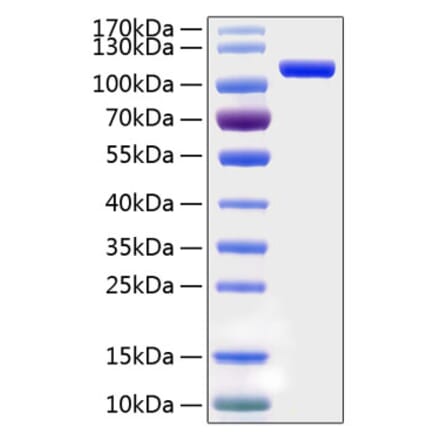 SDS-PAGE - Recombinant Human SEMA5A Protein (C-terminal His Tag) (A331853) - Antibodies.com