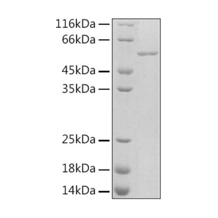 SDS-PAGE - Recombinant Rat PAI1 Protein (C-terminal His Tag) (A331854) - Antibodies.com