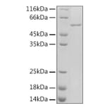 SDS-PAGE - Recombinant Rat PAI1 Protein (C-terminal His Tag) (A331854) - Antibodies.com