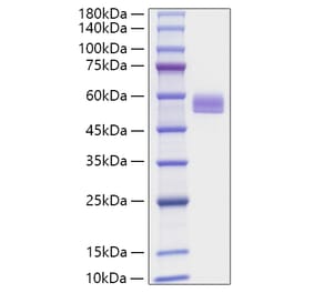 SDS-PAGE - Recombinant Mouse PEDF Protein (C-terminal His Tag) (A331855) - Antibodies.com