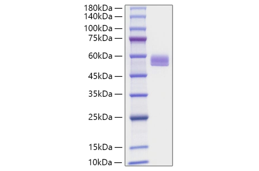SDS-PAGE - Recombinant Mouse PEDF Protein (C-terminal His Tag) (A331855) - Antibodies.com