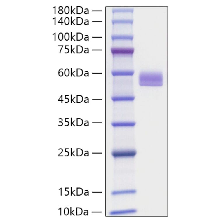 SDS-PAGE - Recombinant Mouse PEDF Protein (C-terminal His Tag) (A331855) - Antibodies.com