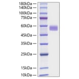 SDS-PAGE - Recombinant Mouse PEDF Protein (C-terminal His Tag) (A331855) - Antibodies.com