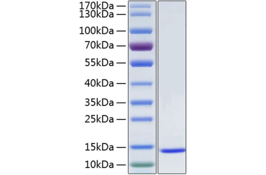 SDS-PAGE - Recombinant Human SAA1 Protein (N-terminal His Tag) (A331858) - Antibodies.com