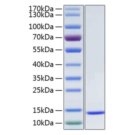 SDS-PAGE - Recombinant Human SAA1 Protein (N-terminal His Tag) (A331858) - Antibodies.com