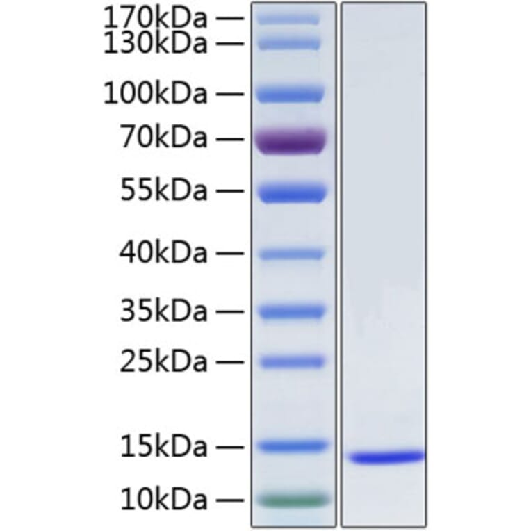 SDS-PAGE - Recombinant Human SAA1 Protein (N-terminal His Tag) (A331858) - Antibodies.com