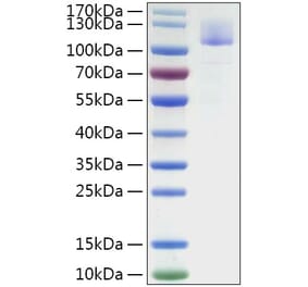 SDS-PAGE - Recombinant Mouse SIGLEC10 Protein (C-terminal Human Fc Tag) (A331859) - Antibodies.com