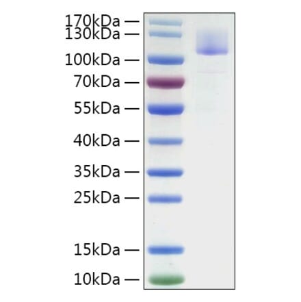 SDS-PAGE - Recombinant Mouse SIGLEC10 Protein (C-terminal Human Fc Tag) (A331859) - Antibodies.com