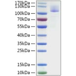 SDS-PAGE - Recombinant Mouse SIGLEC10 Protein (C-terminal Human Fc Tag) (A331859) - Antibodies.com