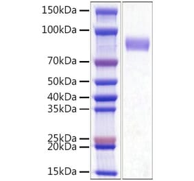 SDS-PAGE - Recombinant Mouse CD33 Protein (C-terminal His Tag) (A331860) - Antibodies.com