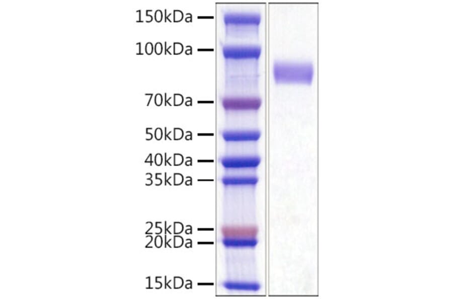 SDS-PAGE - Recombinant Mouse CD33 Protein (C-terminal His Tag) (A331860) - Antibodies.com
