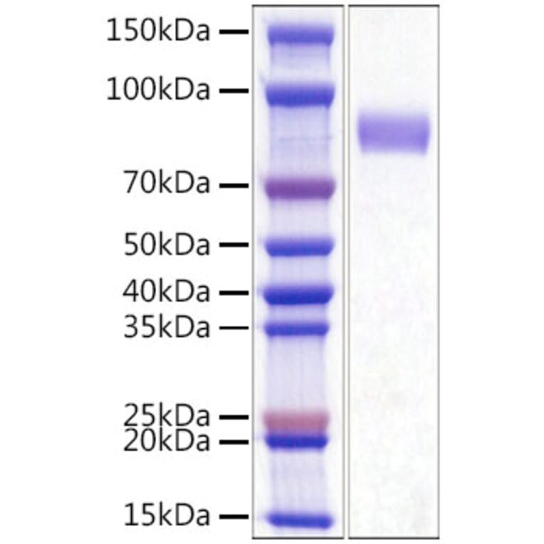 SDS-PAGE - Recombinant Mouse CD33 Protein (C-terminal His Tag) (A331860) - Antibodies.com