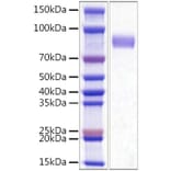 SDS-PAGE - Recombinant Mouse CD33 Protein (C-terminal His Tag) (A331860) - Antibodies.com