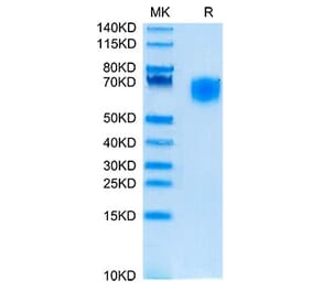 Tris-Bis PAGE - Recombinant Cynomolgus macaque SIRP alpha Protein (C-terminal His Tag) (A331861) - Antibodies.com