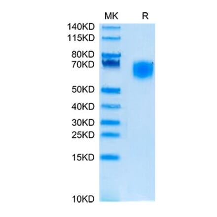 Tris-Bis PAGE - Recombinant Cynomolgus macaque SIRP alpha Protein (C-terminal His Tag) (A331861) - Antibodies.com