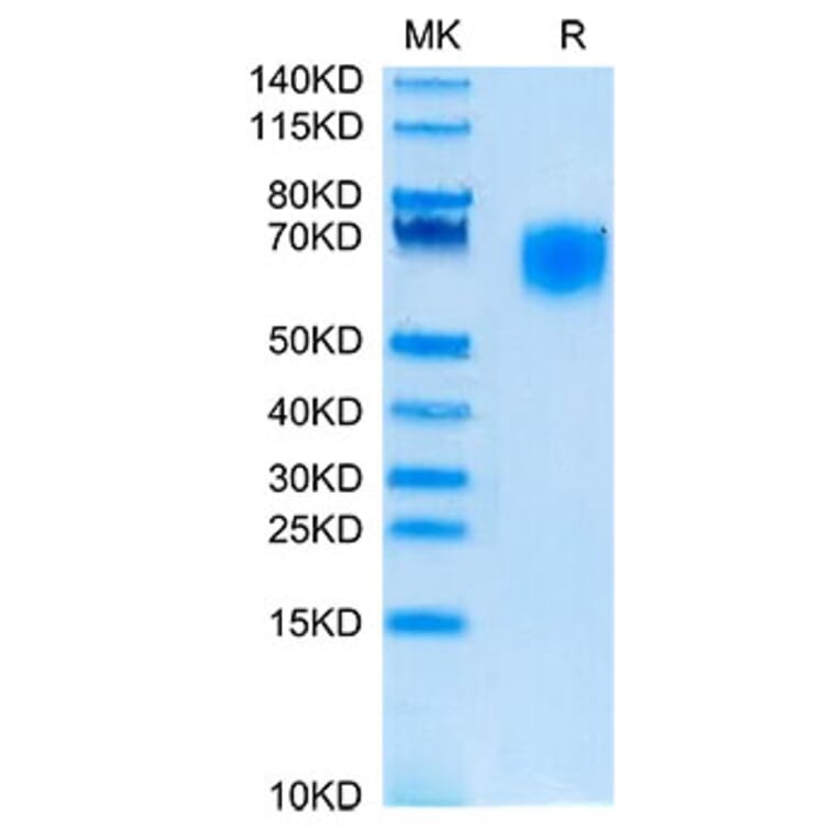 Tris-Bis PAGE - Recombinant Cynomolgus macaque SIRP alpha Protein (C-terminal His Tag) (A331861) - Antibodies.com