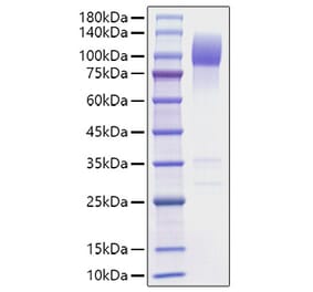 SDS-PAGE - Recombinant Mouse SIRP alpha Protein (C-terminal Human Fc Tag) (A331862) - Antibodies.com