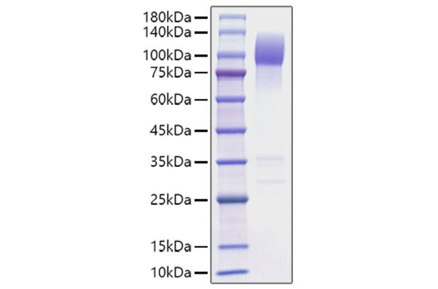 SDS-PAGE - Recombinant Mouse SIRP alpha Protein (C-terminal Human Fc Tag) (A331862) - Antibodies.com